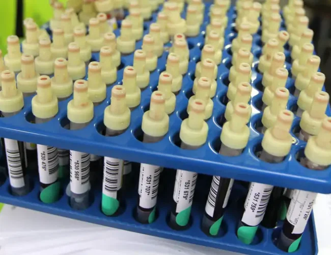 «Gwada negativo»: científicos hallan el grupo sanguíneo más raro del mundo, solo una persona lo posee