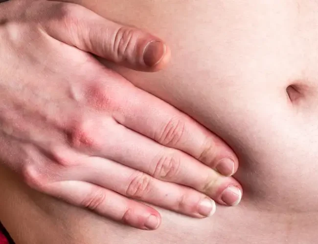 ¿Por qué el cáncer de apéndice aumenta en los jóvenes?