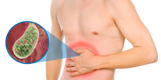 Cálculos en la vesícula: la primera causa de hospitalización en Ecuador y cómo prevenirla