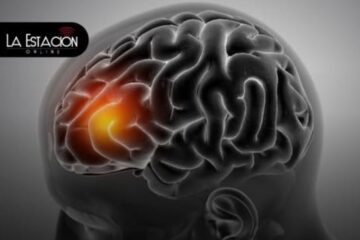 Derrame cerebral: Síntomas y señales de alerta para actuar a tiempo