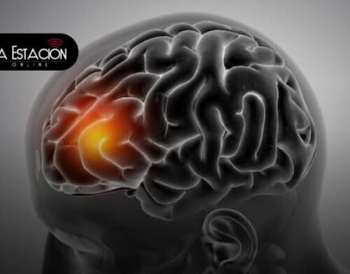 Derrame cerebral: Síntomas y señales de alerta para actuar a tiempo