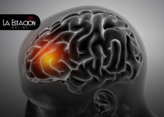 Derrame cerebral: Síntomas y señales de alerta para actuar a tiempo