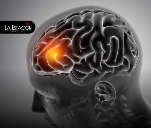 Accidente cerebrovascular: Descubre los perfiles de mayor riesgo